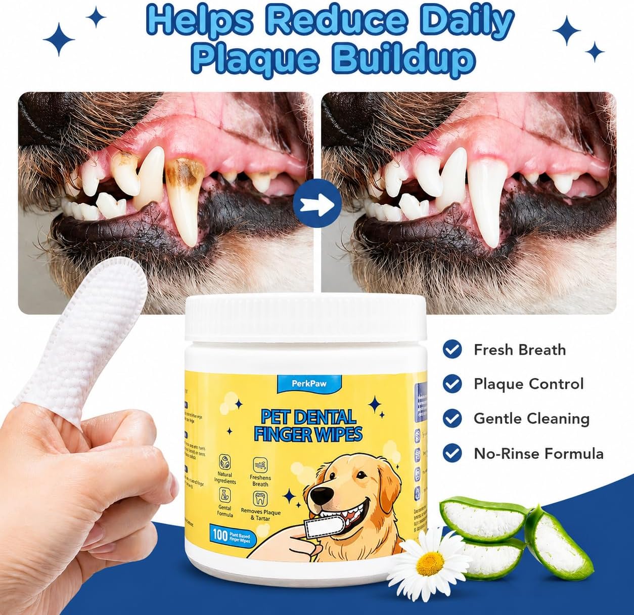 Pet Dental Finger Wipes for Dogs & Cats, 100 Count Pet Teeth Cleaning Wipes, Textured Finger Toothbrush Wipes for Fresh Breath, Plaque & Tartar Care, Gentle No-Rinse Oral Care