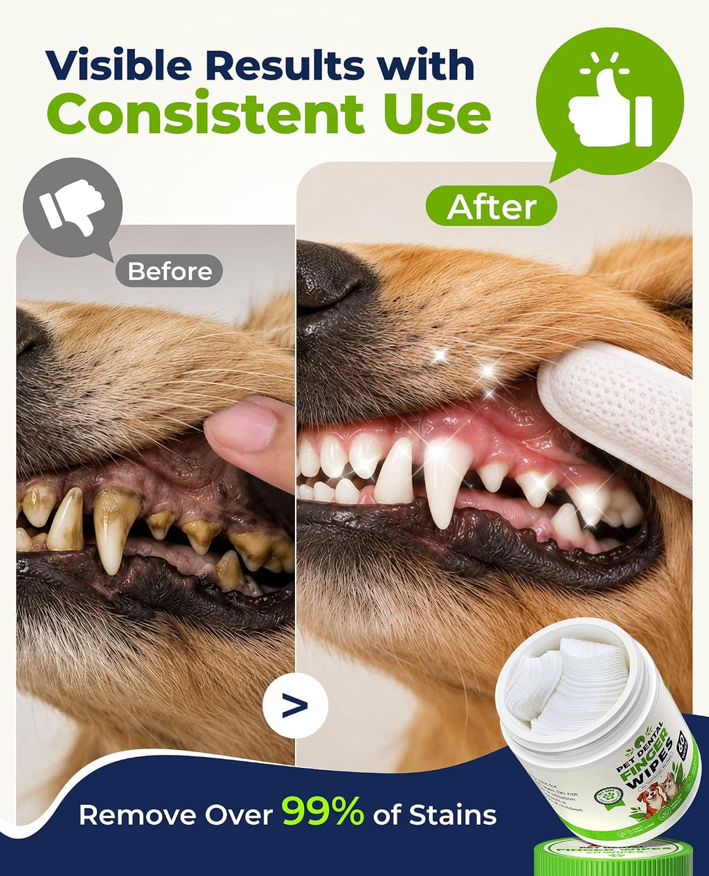 Dog Dental Wipes for Teeth Cleaning, Finger Toothbrush Wipes for Dogs Cats,Dog Teeth Cleaning Wipes Reduce Bad Breath & Plaque Tartar, No-Rinse Daily Oral Care,Dog Toothbrush & Toothpaste Alternatives